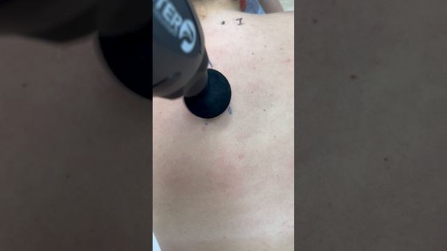 Как перкуссором массировать верхний отдел грудной клетки