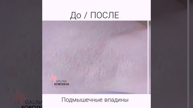 VID_20250130_112637_531.mp4