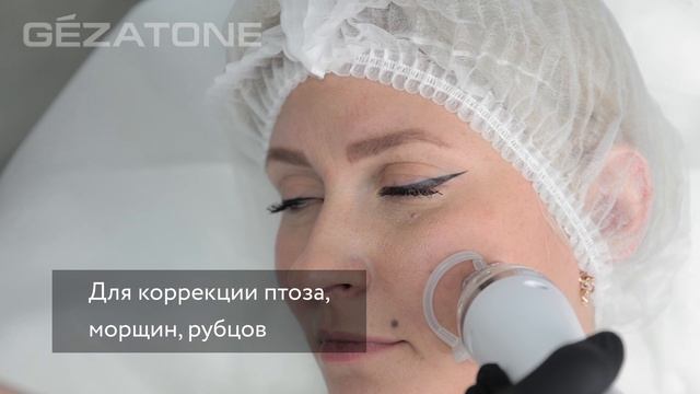 Аппарат микроигольчатого RF-лифтинга для лица и тела m1700, Gezatone