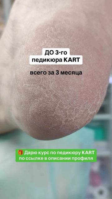 Хочешь научиться также? Проходи курс по ссылке на моем канале БЕСПЛАТНО #shorts #pedicure #nails