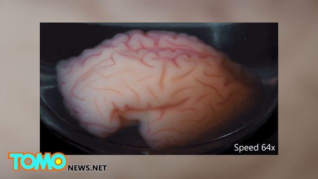 3D gel brain model helps Harvard researchers understand the development of folds - TomoNews