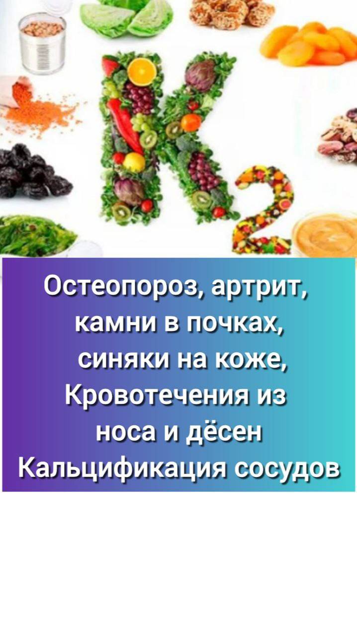 Остеопороз, артрит, камни в почках, кальцификация сосудов, кровотечения из десен и носа.