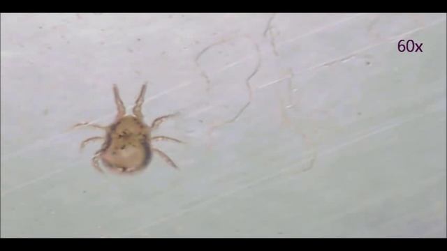 Hühnermilben / Vogelmilben  Nr. 2, Dermanyssus gallinae, gallinae, Red Mite, Chicken Mite
