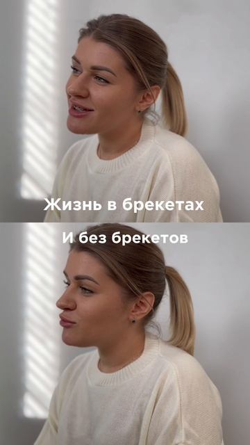 Жизнь в брекетах и без брекетах