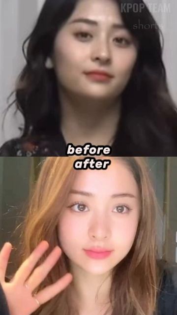 Did LE SSERAFIM Yunjin Undergo Plastic Surgery? BEFORE / AFTER #shorts #yunjin #lesserafim