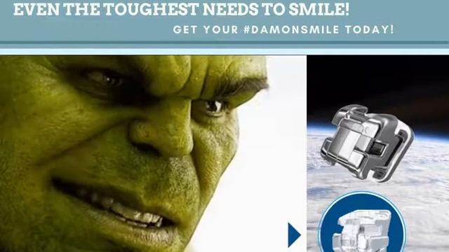 Ormco - Toughest need to Smile