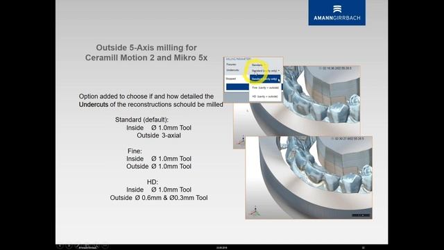 4 axis vs. 5 axis milling in the dental lab