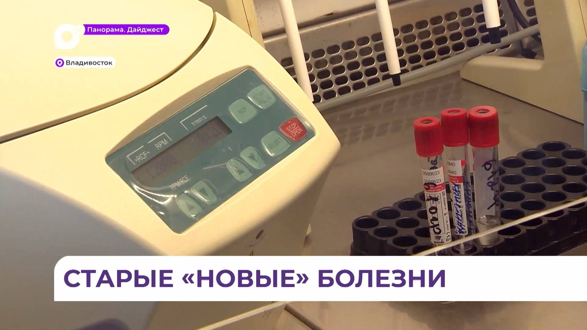 Во Владивостоке за уровнем заболеваемости ОРВИ и гриппом следят в лаборатории вирусных инфекций