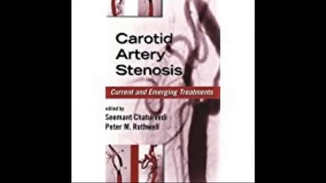 Carotid Artery Stenosis Current and Emerging Treatments Neurological Disease and Therapy