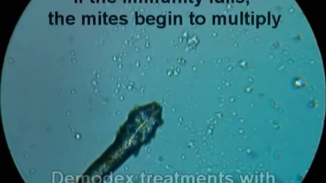 Demodex Folliculorum, How to Cure Demodex