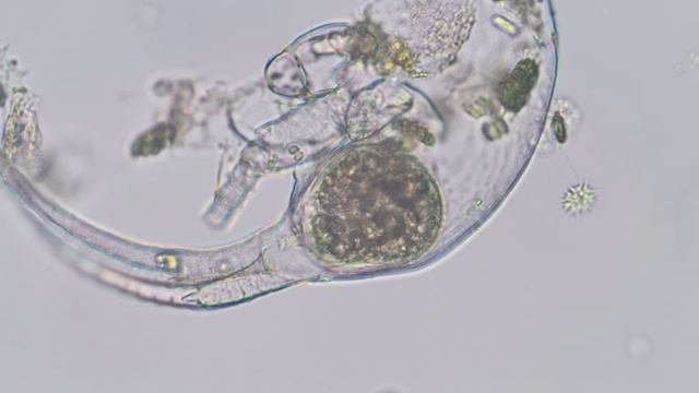 Ciliate inside a Bosmina head - life and death under the microscope