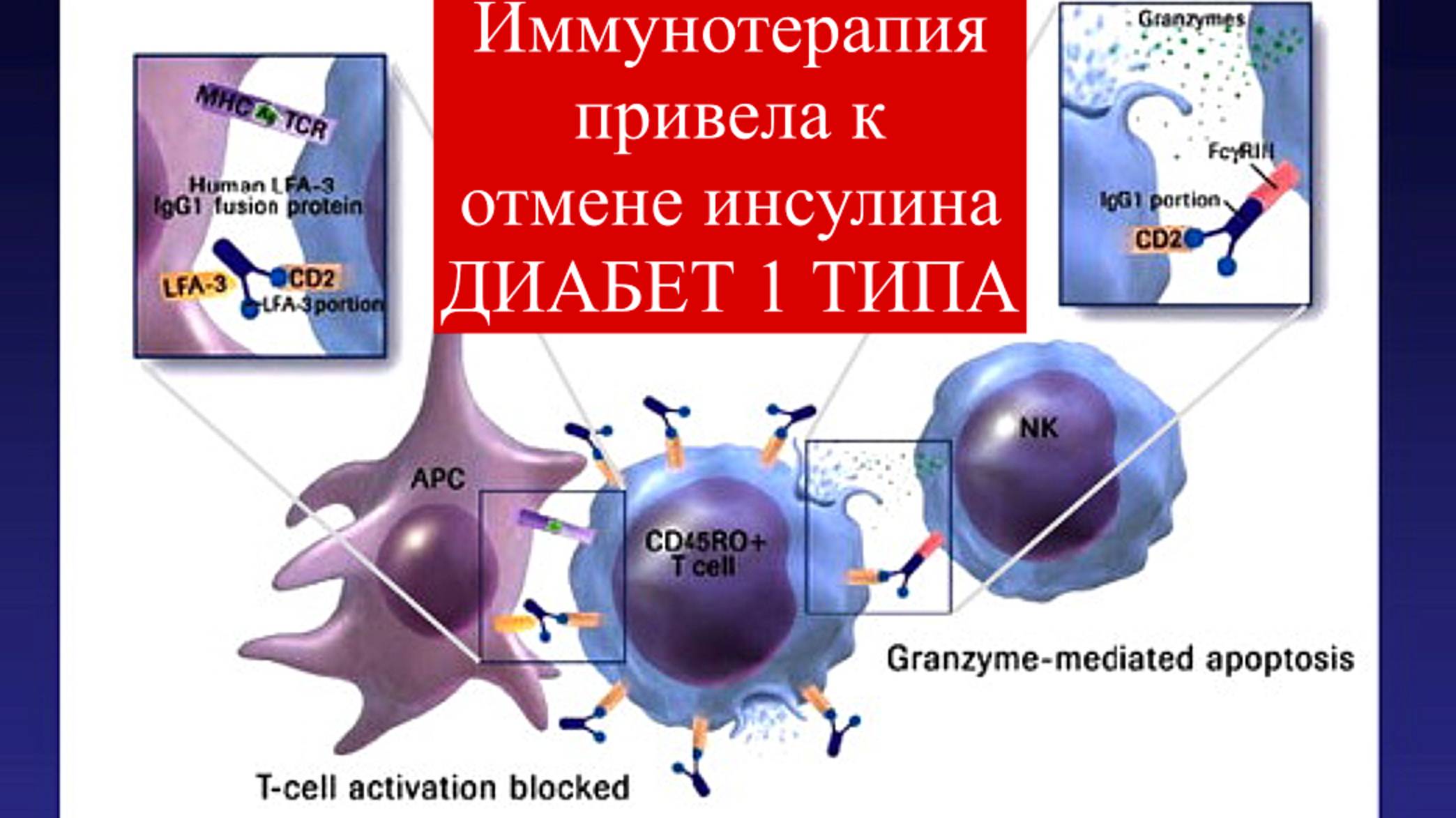 #лечениедиабета #диабет1типа #диабет