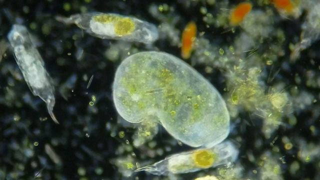 La Ballena (Stentor roeselii, Ciliophora), las Orcas (Cephalodella forficula, Rotífero) y la charca