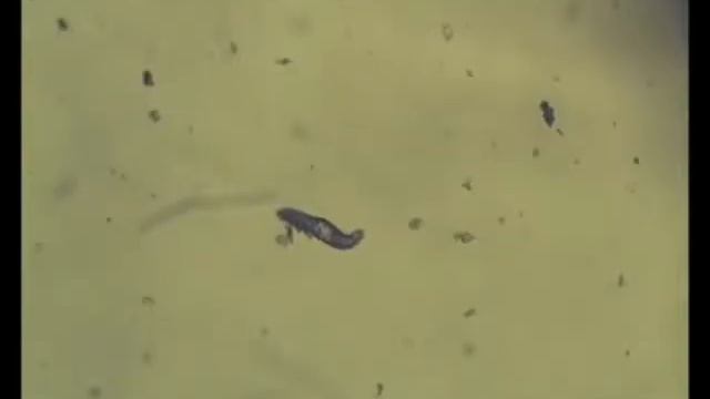 Demodex canis (dog parasite)