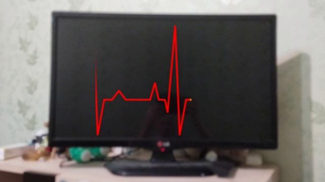 The device who are in the hospital with a pulse reading