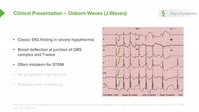 1.02 Accidental Hypothermia- Symptoms