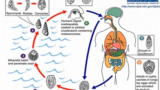 Parasitology - Paragonimus westermani / د. خالد جميل