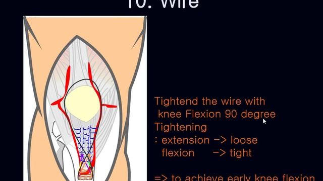 Knee Patellar Tendon Avulsion Pediatric