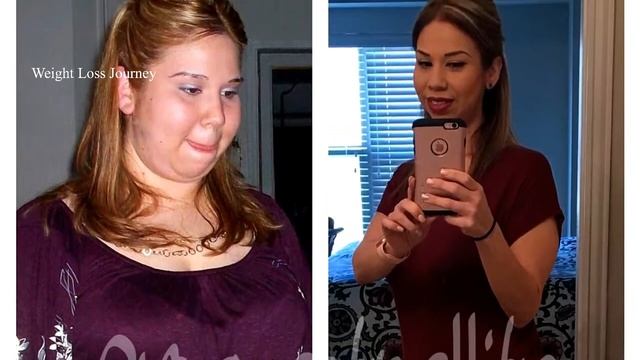80 Pound Weight Loss Transformation in 1 Month || Before and After Photos || Weight Loss Journey