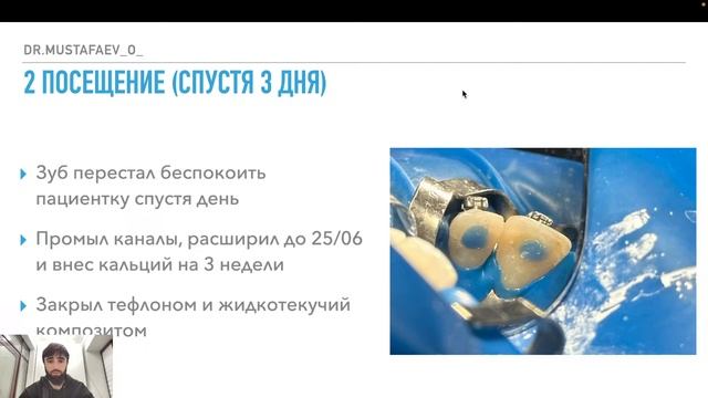 ОСТРЫЙ АПИКАЛЬНЫЙ АБСЦЕСС - бесплатный вебинар для стоматологов