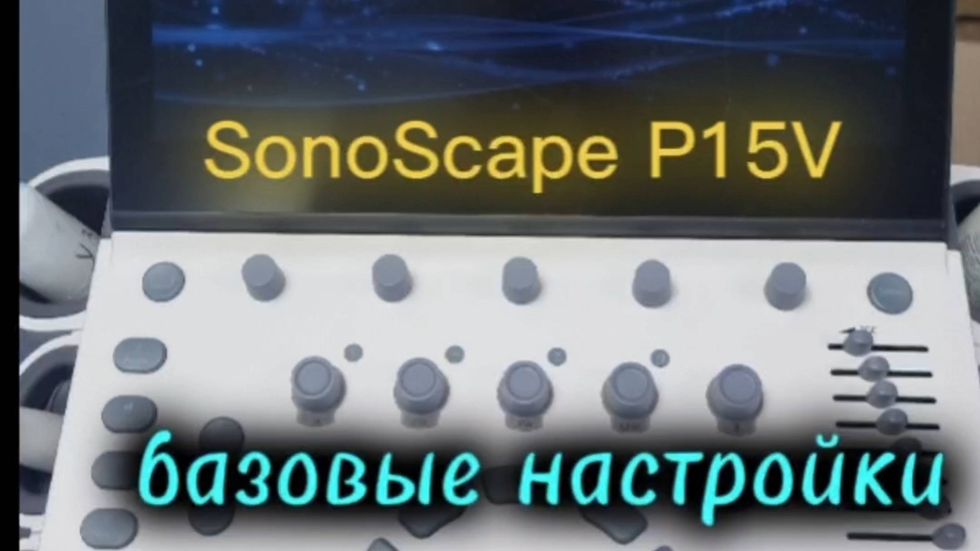 Базовые настройки SonoScape P15V