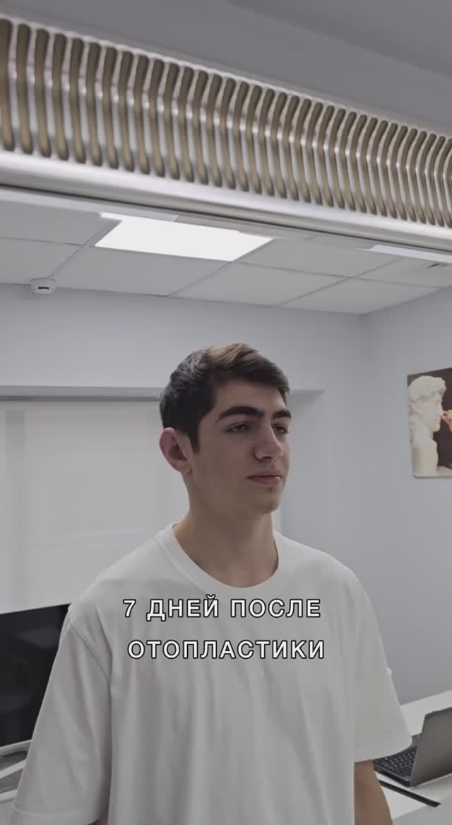Первое впечатление после отопластики.