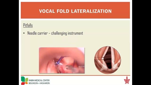 USC Caruso Department of Otolaryngology – Head and Neck Surgery: Grand Rounds (01/22/2021 - Part 1)