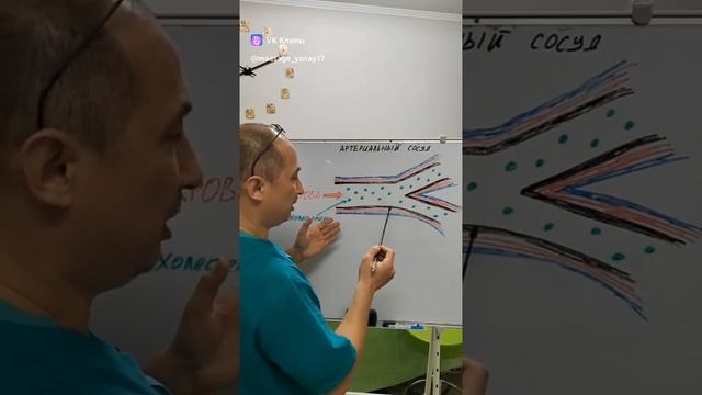 Атеросклероз. Сценарий развития.