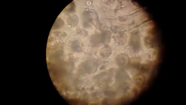 Protozoarios en intestino de termitas