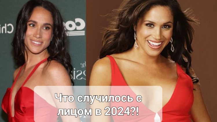 А что с лицом?! + Mеган Маркл: 3 тайны фигуры + 4 намекa на 3-ю беременность - все, что нужно знать!