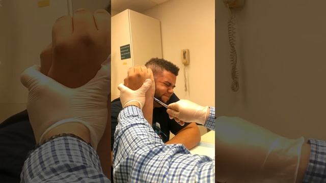 Boxers fracture pin removal