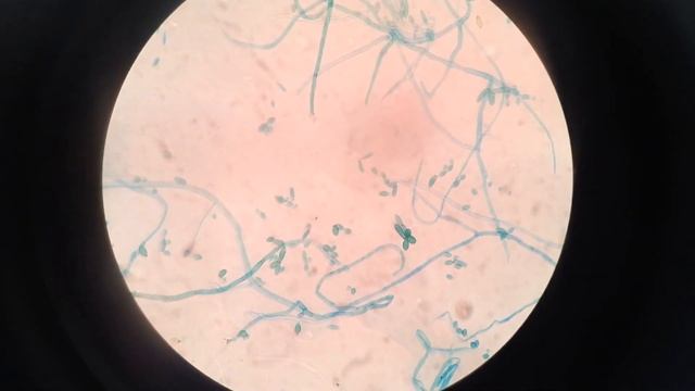 Cladosporium on SDA and its fungal structures on LPCB preparation