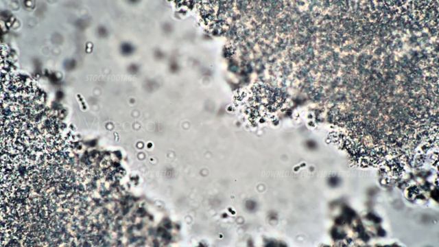 Corridor from stream of lactic acid bacteria in dairy starter in microscope