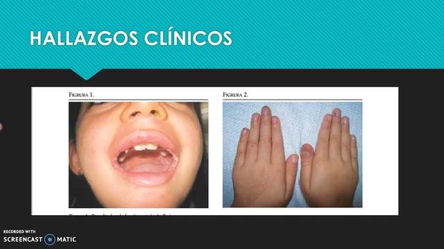 Candidiasis mucocutanea reporte de caso