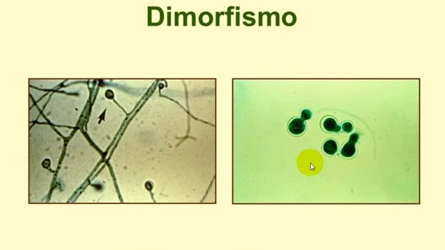 Tmmed infectología - INFECTOLOGIA 1 D