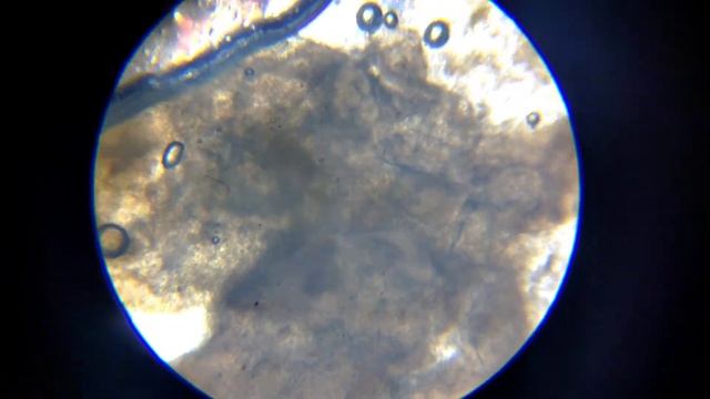 Soaked Infected Skin Under Microscope | Microorganisms Eating My Skin