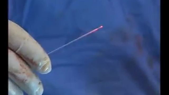 Veselas Venas