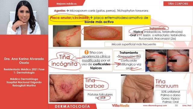 5 Dermatología   Micosis cutáneas