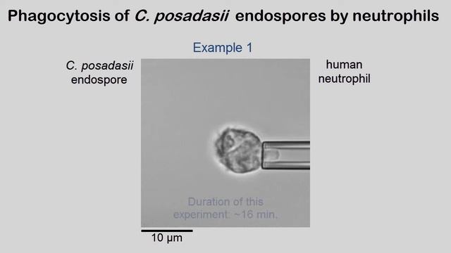 Phagocytosis of Coccidioides posadasii endospores by human neutrophils