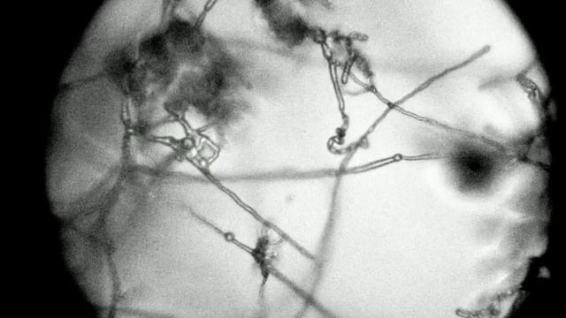Metarhizium anisopliae 2