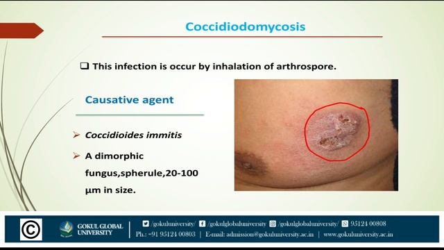 Clinical Mycology Part-II - Clinical Microbiology - PGDMLT - GSC