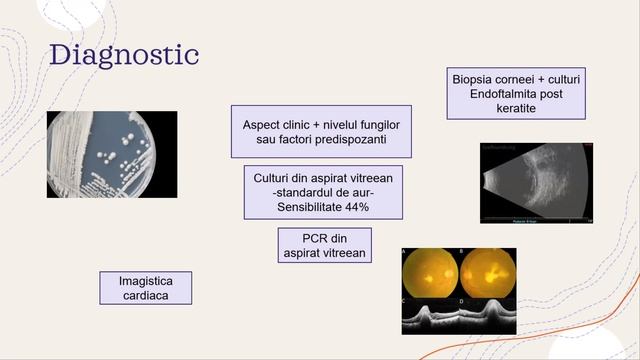 Uveitis part 2 Yanoff Workshop