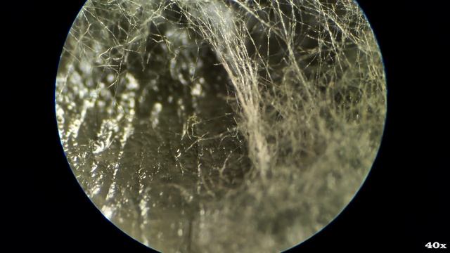 MOLD Under Microscope