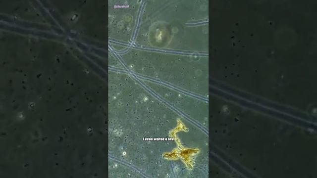 Old Penicillin vs Germs Under Microscope