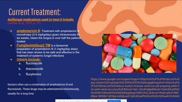Cryptococcal meningitis