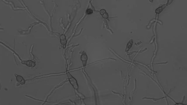 Developing Maganporthe oryzae conidia