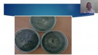 ট্রাইকোডার্মা উৎপাদন পদ্ধতি ( Production Technology of Trichoderma)