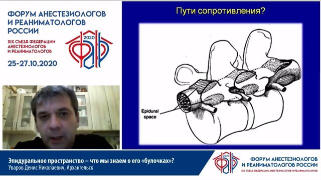 Эпидуральное пространство - что мы знаем о его «булочках»_ Уваров Д. Н.