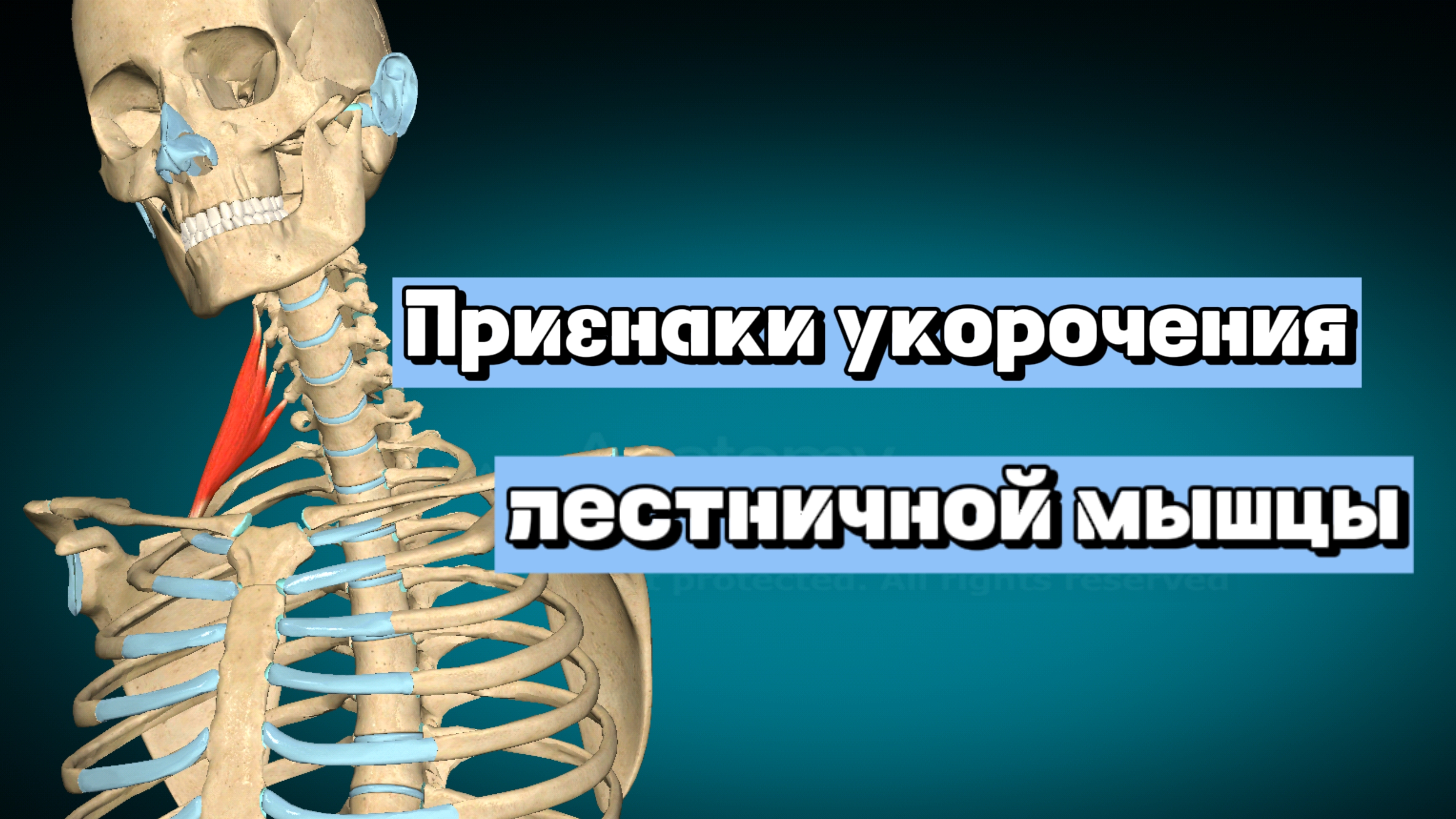 Признаки укорочения лестничной мышцы
