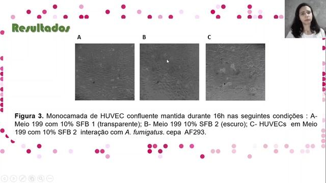 Obtenção de microvesículas secretadas por HUVECs em resposta ao fungo Aspergillus fumigatus